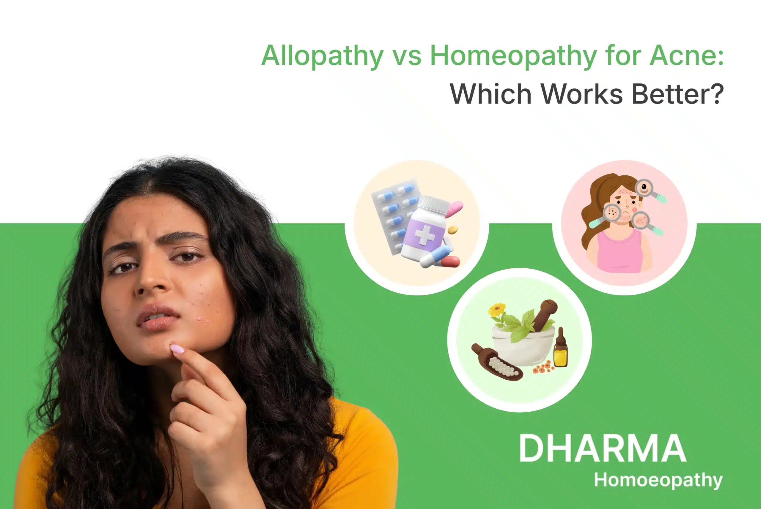 Allopathy vs Homeopathy for Acne Which Works Better