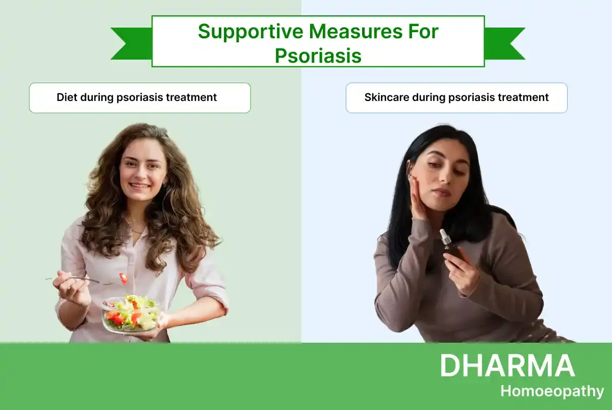 Supportive Measures For Psoriasis