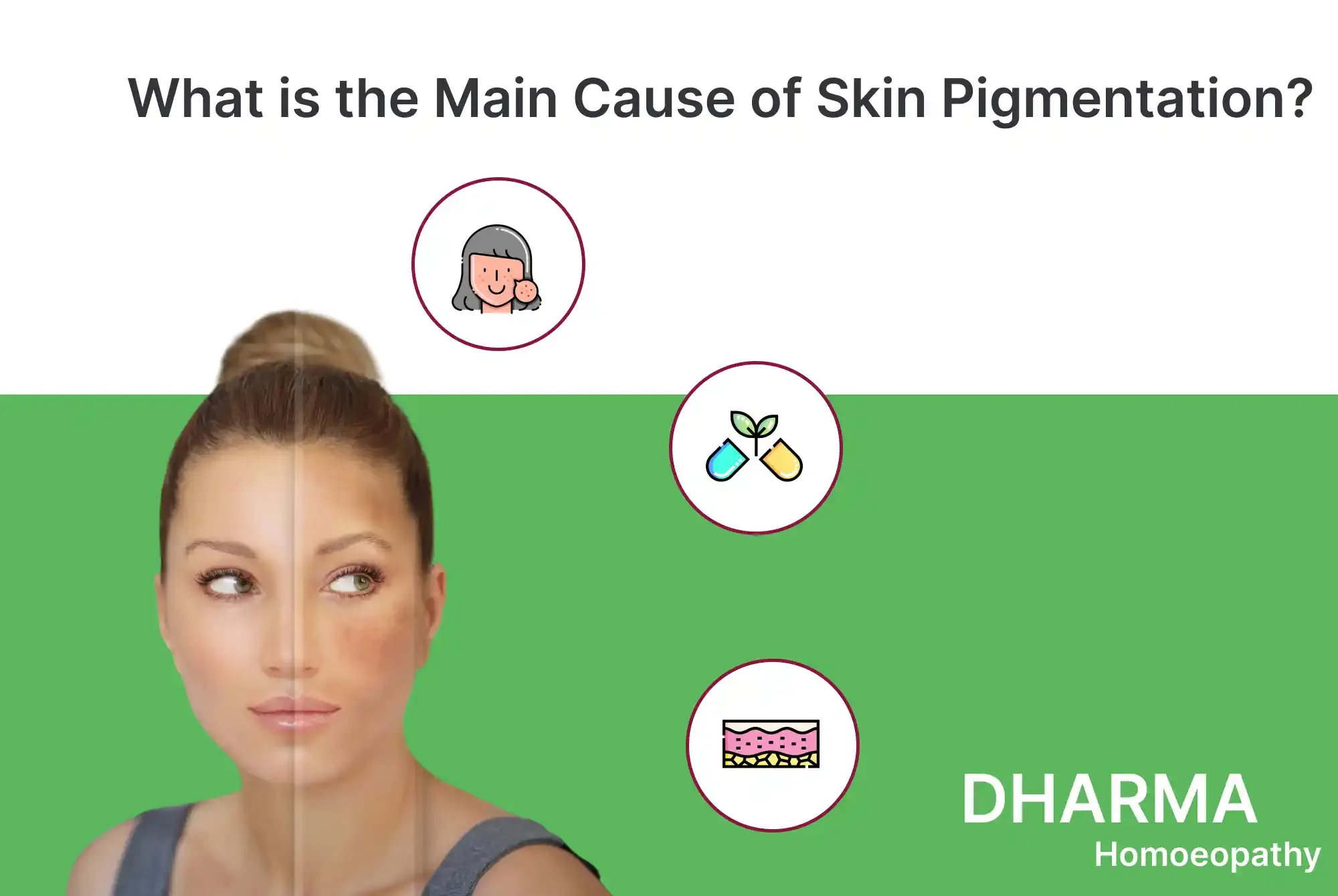 What is the Main Cause of Skin Pigmentation