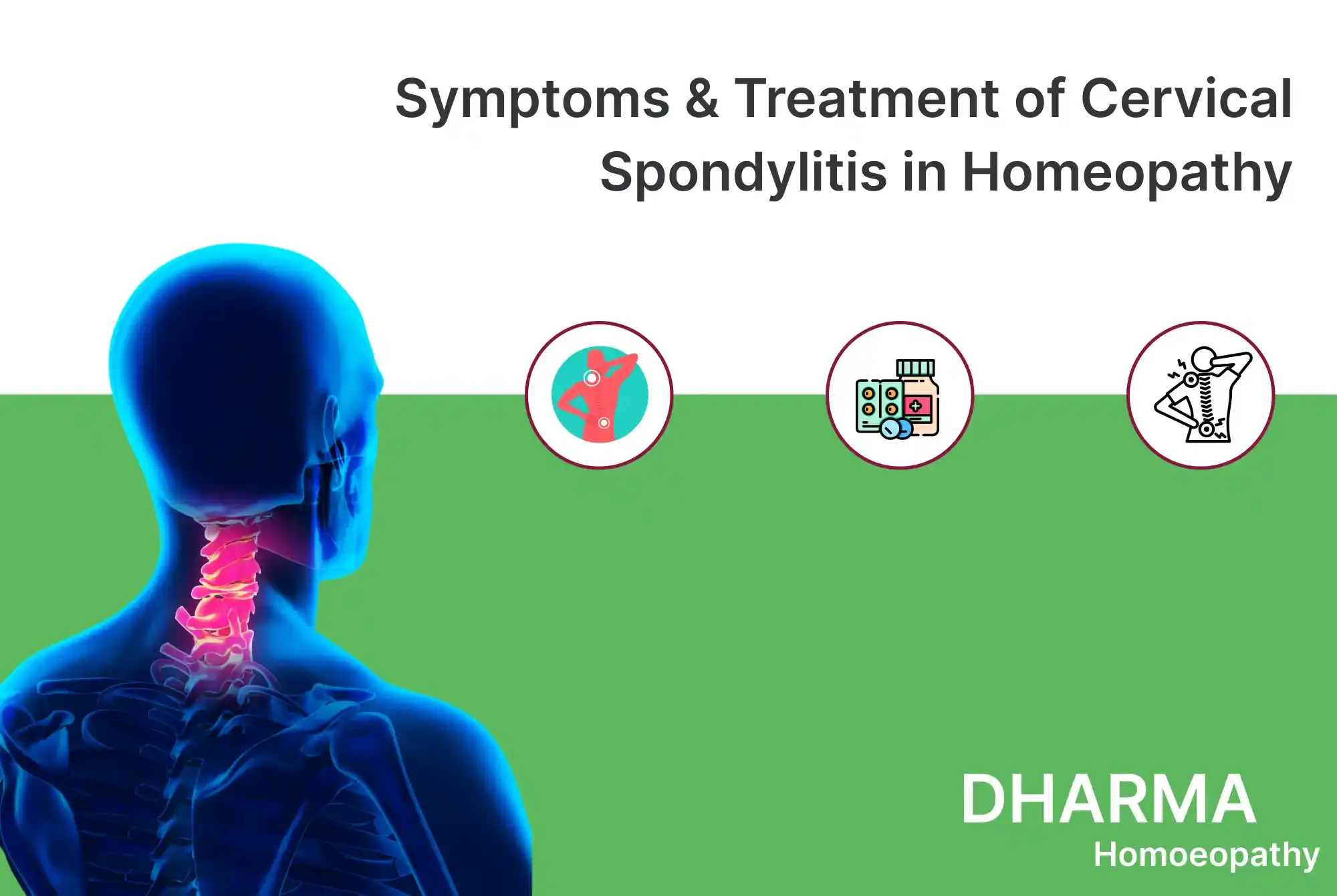 Symptoms & Treatment of Cervical Spondylitis in Homeopathy