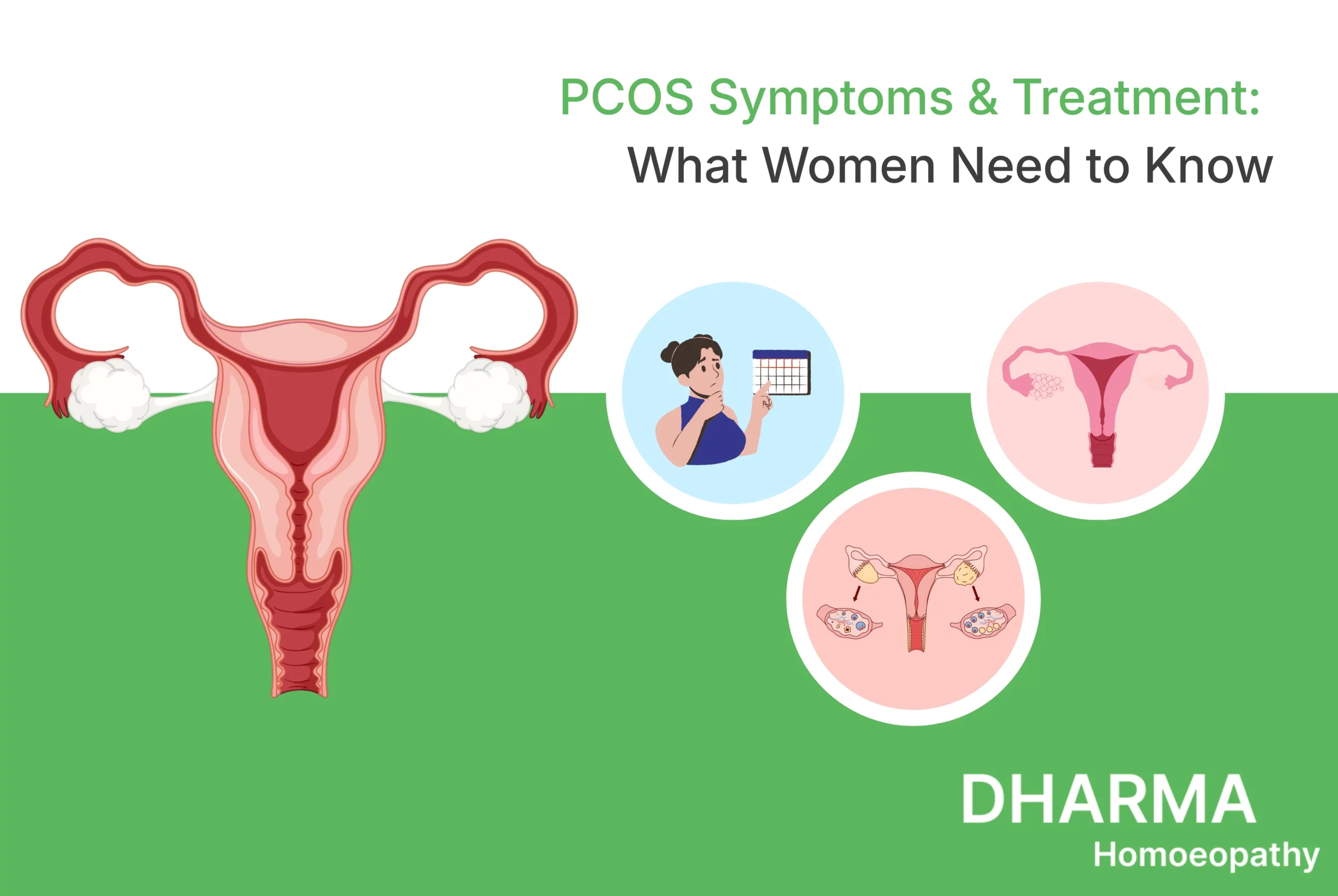 PCOS Symptoms & Treatment What Women Need to Know