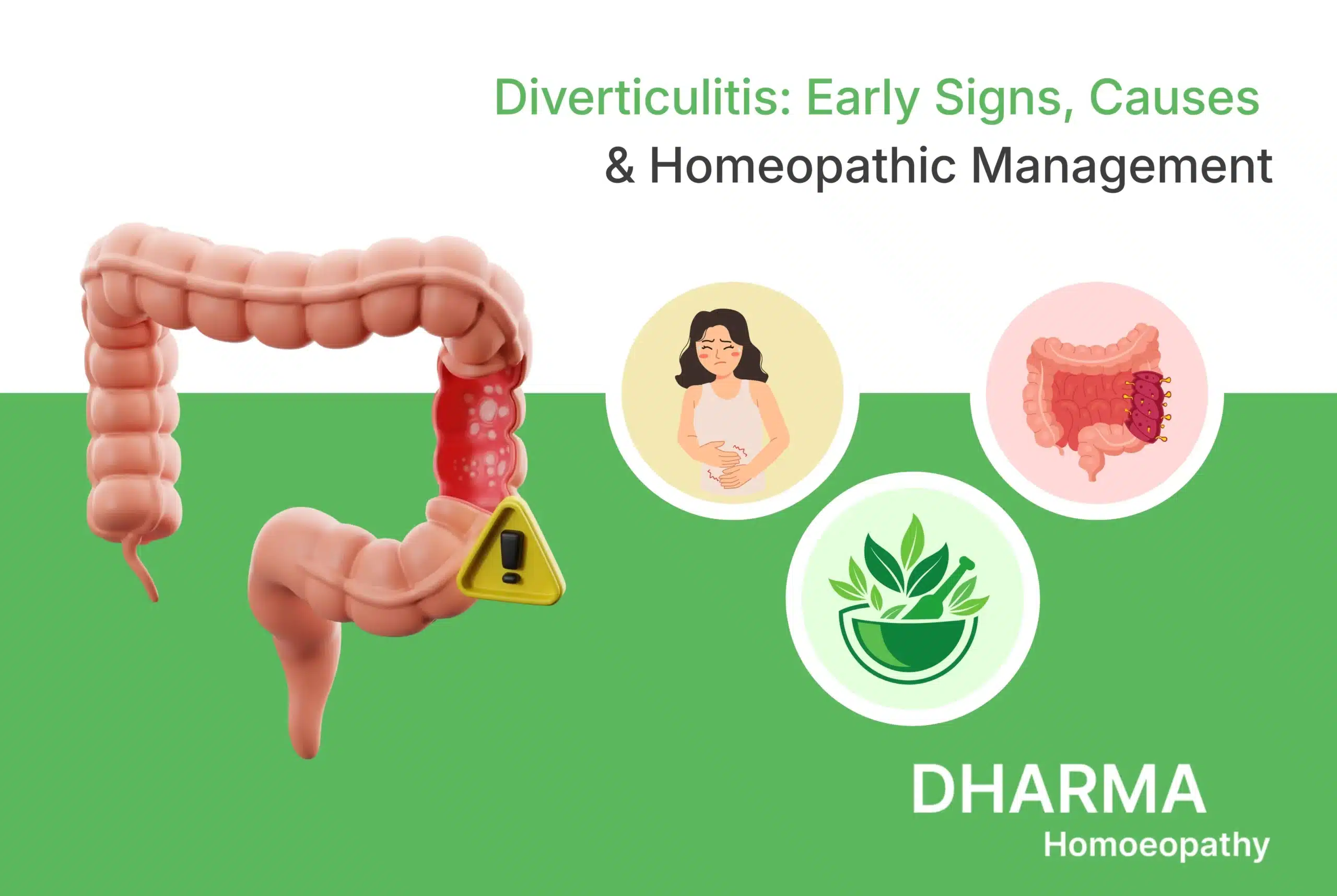 Diverticulitis Early Signs, Causes & Homeopathic Management